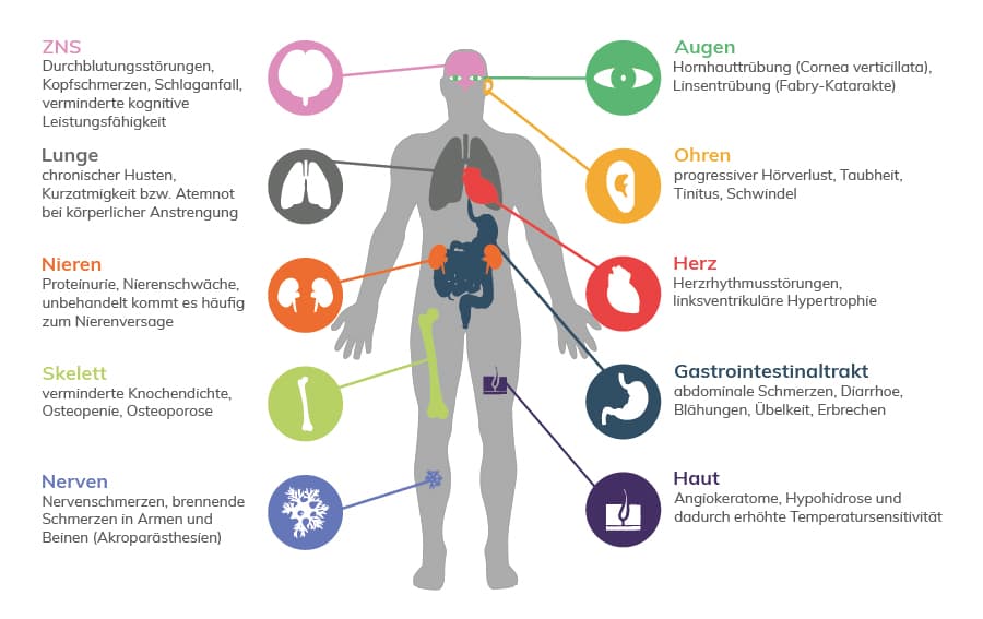 Infografik, die die Symptome der Fabry-Krankheit zeigt, einschließlich Durchblutungsstörungen im Gehirn, Lungensymptome, Nierenbeeinträchtigung, Skelettveränderungen, Nervenschmerzen, sowie Probleme mit Herz, Gastrointestinaltrakt, Haut, Augen und Ohren, jeweils verbunden mit dem entsprechenden Organ oder Bereich auf einer menschlichen Silhouette.